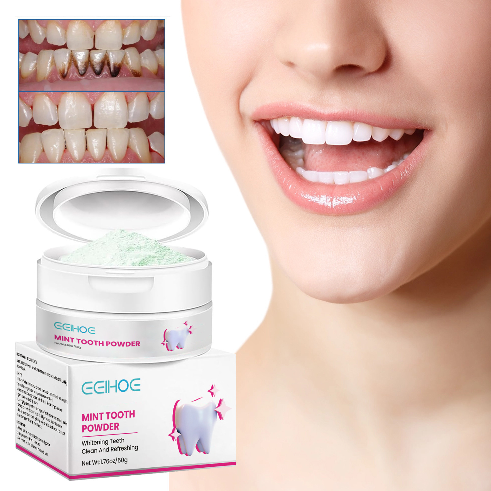 Shop Clearance! Tooth Repair Kit-Moldable False Teeth for Snap On Instant  and Confident Smile 50g/100g 