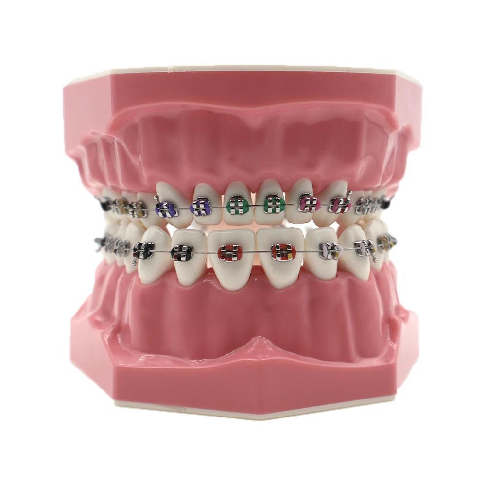 Dental Typodont With Ceramic Brackets Orthodontic Braces Teeth Model,28pcs  Teeth Ceramic Braces Model For Teaching Practice