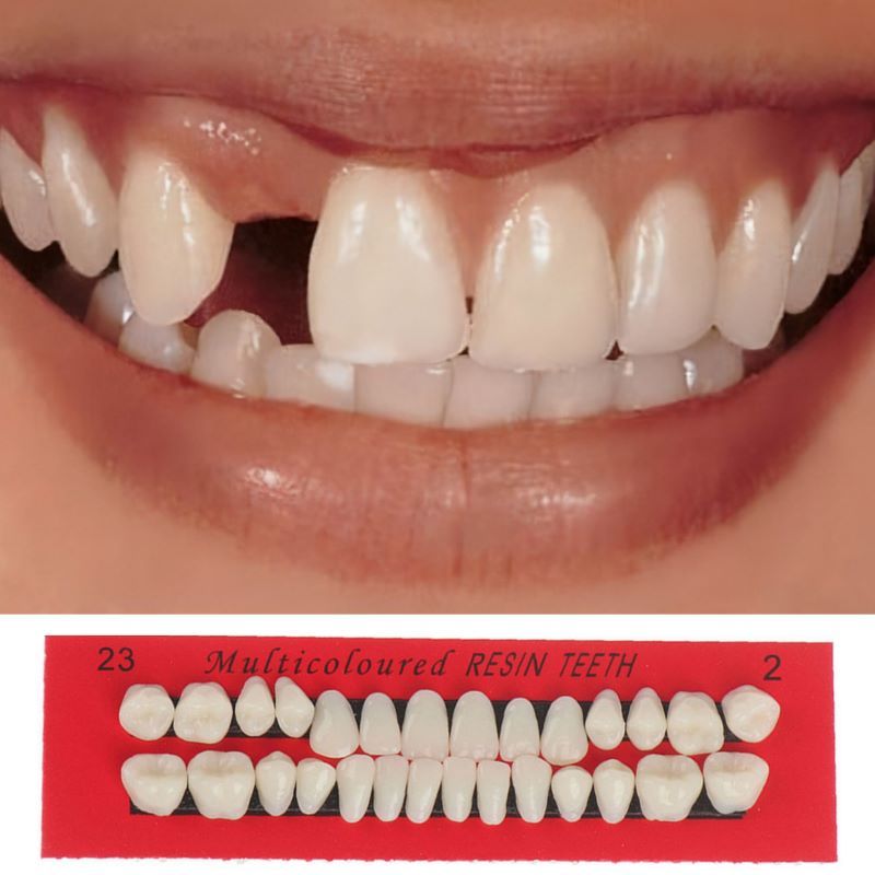1pc Colla Per Dentiere False, Kit Di Riparazione Temporanea Dei Denti,  Adesivo Per Dentiere False E Lacune, Set Di Strumenti Per La Cura Dei Denti  Per