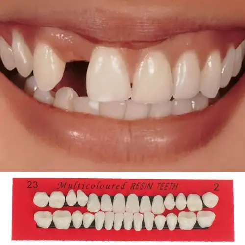 1 Set Kit Di Stampi Per Faccette Dentali, Resina Composita Ultra Sottile A  Cura Di Luce Temporanea Anteriore Corona Sbiancante - Temu Italy