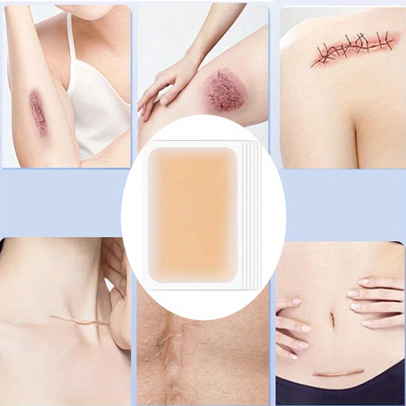 

6pcs Ultra-thin Acne Scar Cover Patches, Waterproof And Breathable, Self-adhesive Skin Tone Pads, Gradient Edge Design