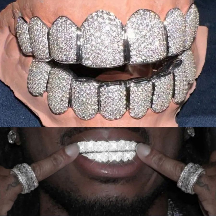 VICASKY 2 Fundas De Dientes Plateadas Con Estilo Hip Hop – Joyas Dentales Para Fiestas, Accesorios Llamativos Para Halloween Y Cosplay, Para Hombres Y Mujeres