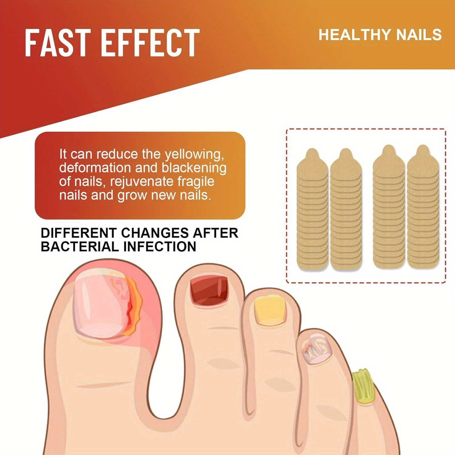 Fungal Nail Patches Nighttime Renewal Overnight Nail Repair For Nail ...