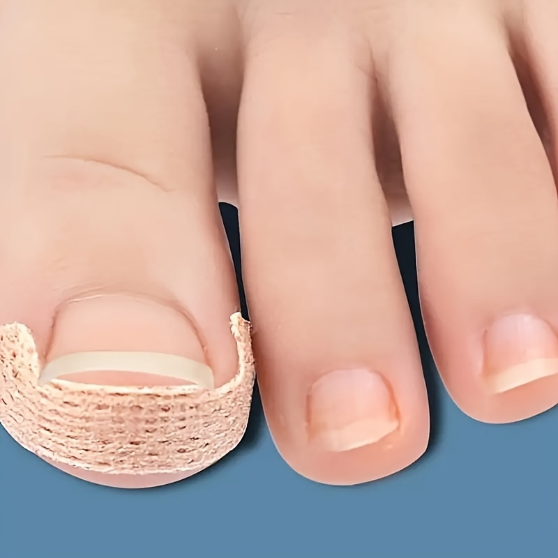 120pcs Ingrown Toenail Special Tools, Breathable Bandages