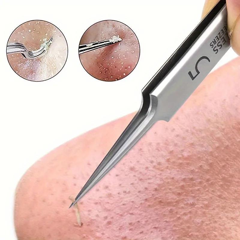 

For Removing Blackheads And , Stainless Steel, Suitable , No