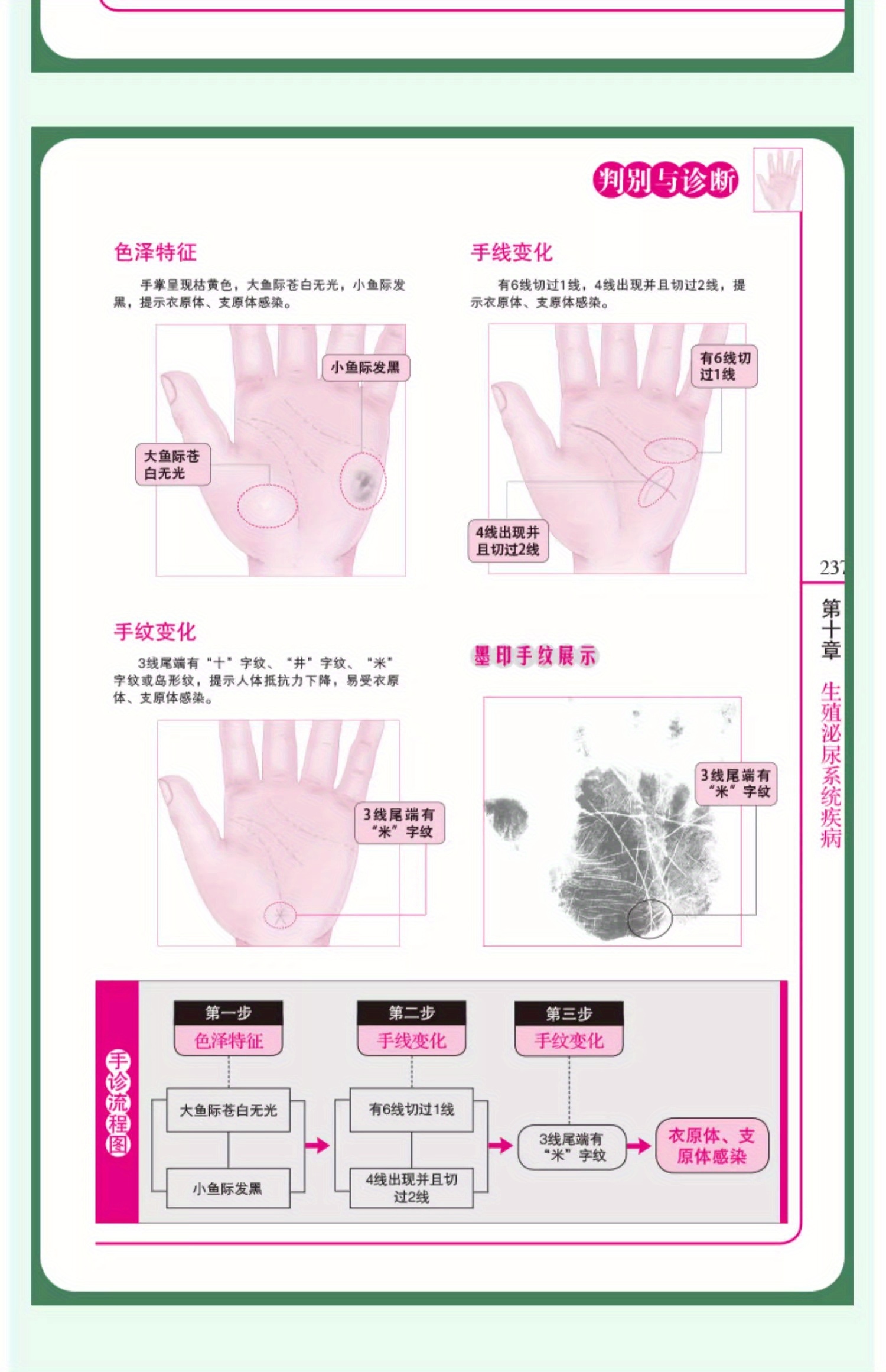Learn Traditional Chinese Medicine from Life: Learn Hand Diagnosis and You Will Be Able to Learn How to Live a Healthy Life, Prevent Common Diseases, Hand Discrimination, Basic Hand Diagnosis, Introduction to Traditional Chinese Medicine, Know Health by Observing Hands, Learn Traditional Chinese Medicine and Health Care Books to Prevent and Treat Diseases Chinese Version
