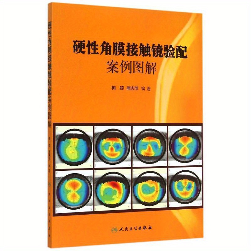 Illustrated Case Study of Fitting Rigid Gas Permeable Contact Lenses. Chinese Version