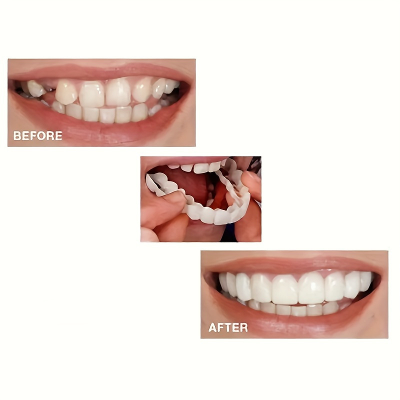 2pcs set white dentures with veneers upper and lower denture care for men and women flexible comfortable lifelike details 5