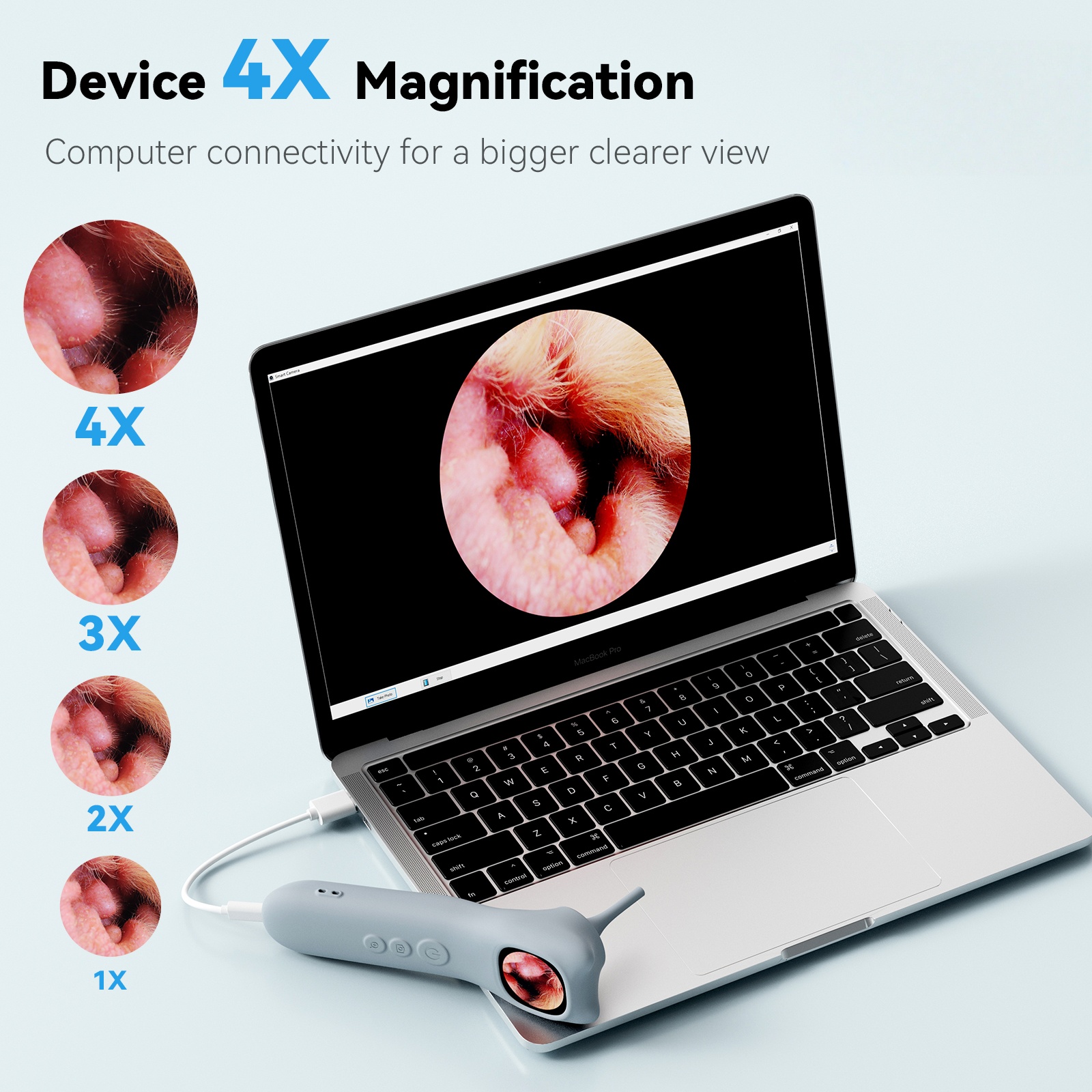This Home-Use Pet Smart Detector Combines Four Functions in One, Featuring a 1080P High-Definition Ear Endoscope Camera with 4X Zoom for Clear Internal Viewing. It Comes with 12 Specialized Examination Heads to Fit Different Body Parts