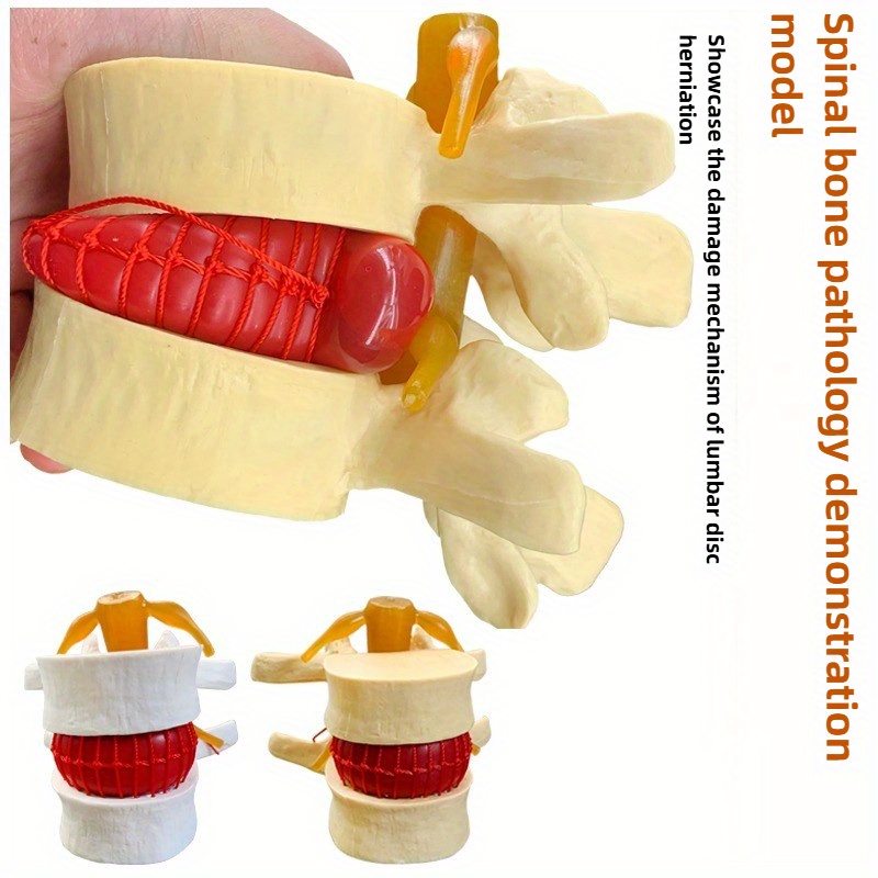 

Modèle Éducatif de Lombaire - Démonstration de des Articulations de Vertébrale en PVC Blanc avec Compression du Disque Agrandi et Pression Latérale, Idéal pour Étudiants et , Médecine, Osseuse