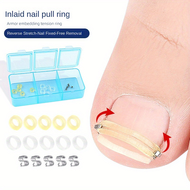 

1 Set Toe Inlaid Ring Stretch Rebound, Pattern Nail Physical Reverse Stretch, Washable And Reusable, Nail Care Tools For Foot, Hand And Nail Care