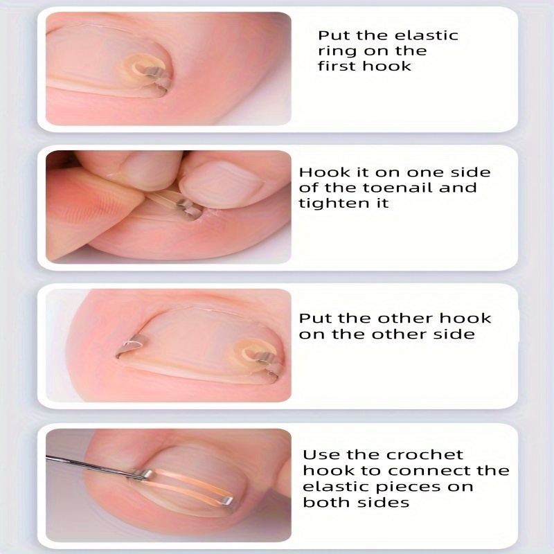 Embedded Nail Care Tool Set for Personal Foot Care