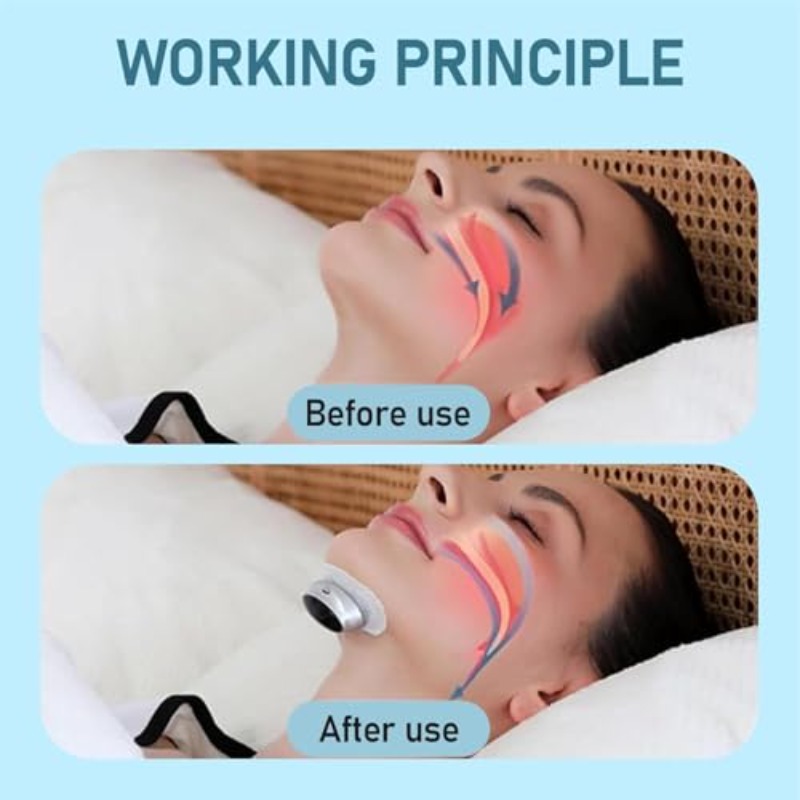 Jeremytis Z3 Pro Anti-Snoring Device - Smart 3-Speed Adjustable CPAP, Portable Anti Snore Machine with Instant, Comfortable & Side-Effect-Free Sleep Aid for Men &, Travel-Friendly Snore Solution
