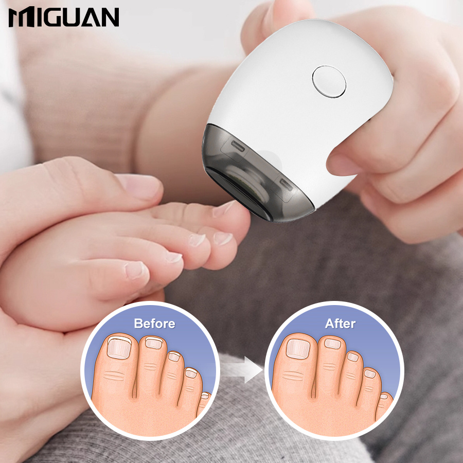 Elektrischer Nagelknipser Mit LED-Licht – USB-C Ladbar, 2 Geschwindigkeiten, Leise, Für Kinder, Senioren & Erwachsene