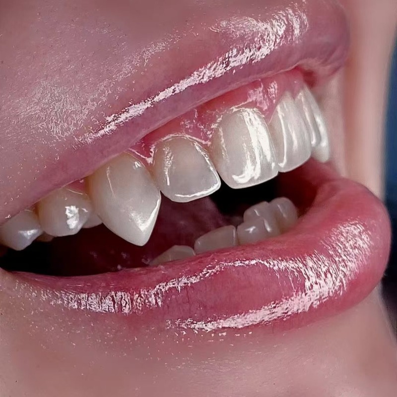 Halloween Hip-Hop Teeth Fake Teeth 5pcs Set for Cosplay