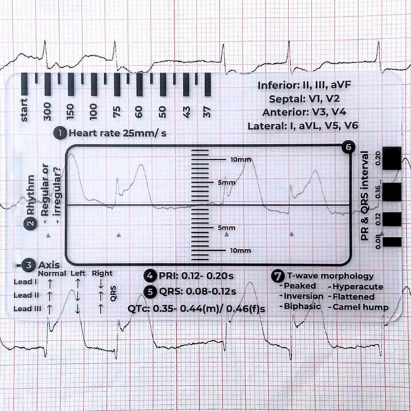 

Ecg 7-step Ruler, 8654mm Transparent Plastic Portable Ecg Ruler, Pocket Cassette Protective Cover, Ecg Badge Card Measurement Tool, White