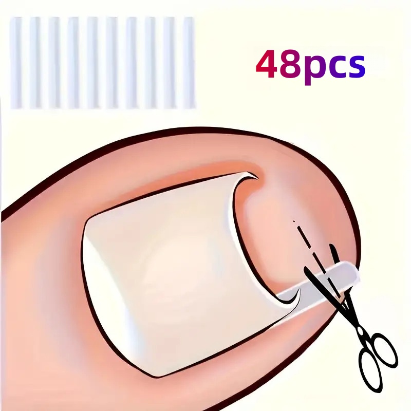 48pcs Long Nail Correction Kit, Foot Care Tools Designed To Prevent Friction And Pressure, Includes Nail Filling Material