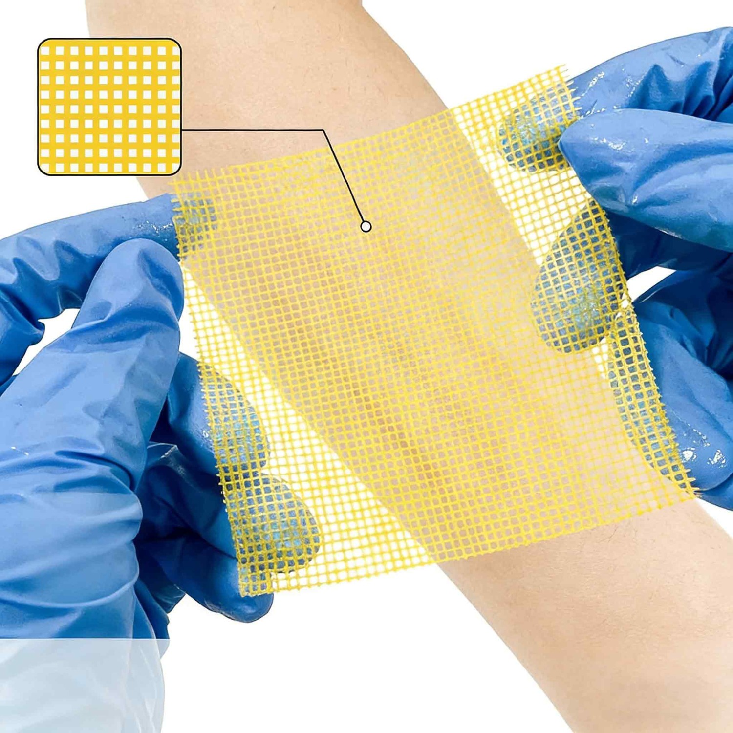 Wound Honey Dressing Foam Bandages, Honey Bandage Wound Care Pad, Adhesive Border 10.16cm'x10.16cm' Breathable Bed Pressure Dressing, Protective Padding, Foam Cushioning, Soft Foam Patches, Smooth Texture - Image 2