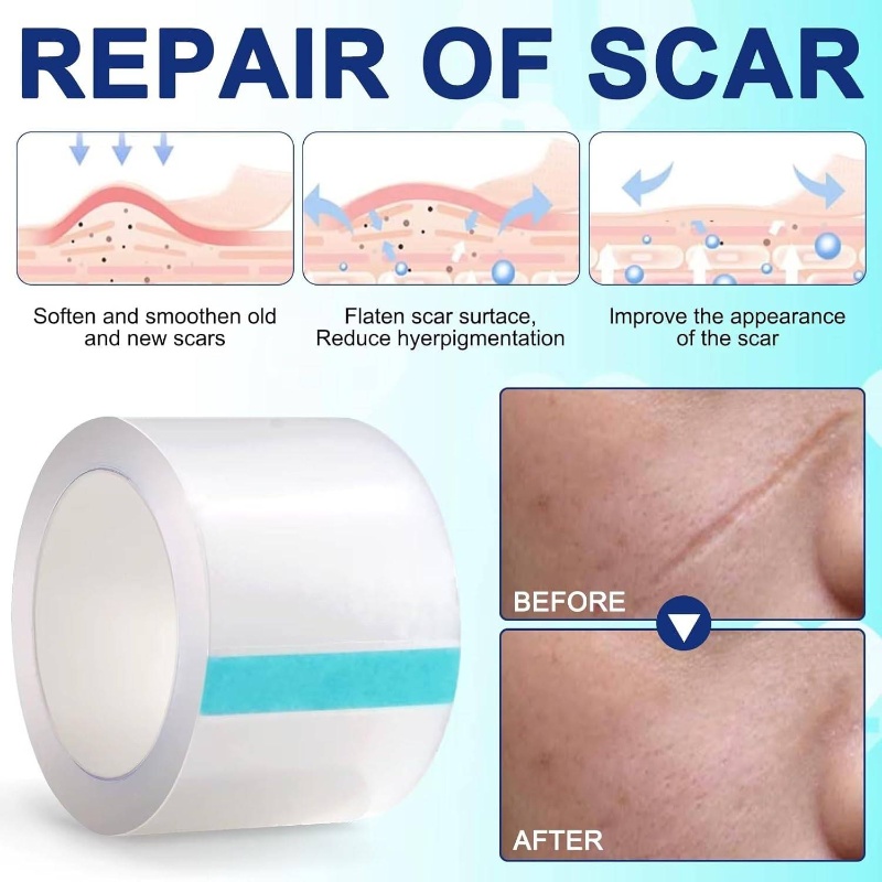 Transparent Patch Tape Reusable, Waterproof, Breathable Strips Lightens and Removes Scratches Old and New Scars 2, 5cm*150cm
