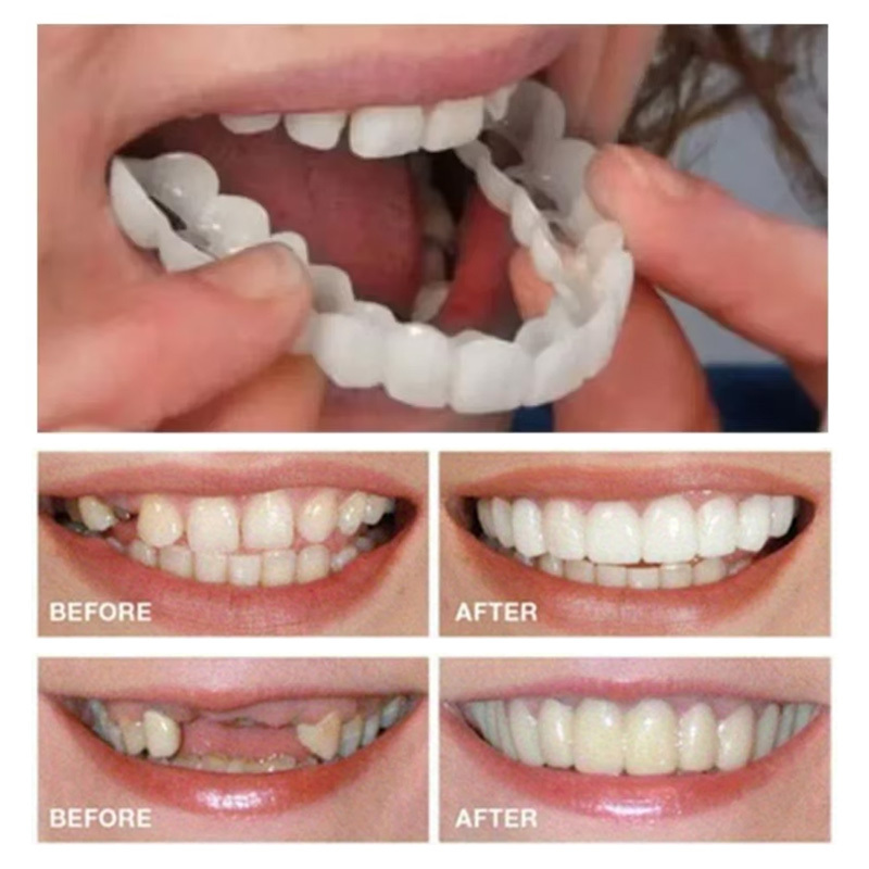 

2pcs/ Set White Dentures With Veneers - Upper And Lower Denture Care For Men And Women - Flexible, Comfortable, Lifelike