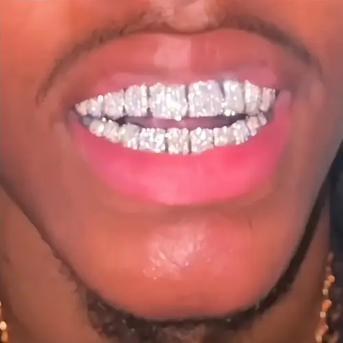 Female Rapper Teeth teeth grills sold on Temu United States