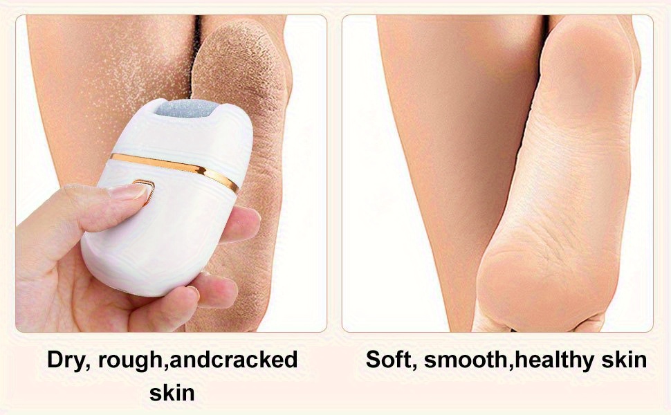 Foot Reflexology Foot Dermabrasion File- Portable and Easy to Use with 3 Replaceable Heads Smooth Feet, Thick Polishing and Cracked Light Beige Care, Sander, Grinding