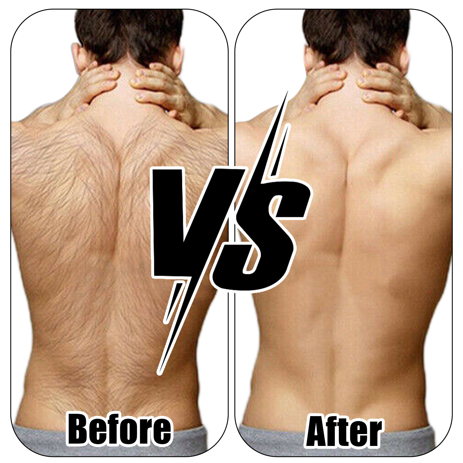 Men's Back Hair Trimmer with 5 Blades and Adjustable Long Handle