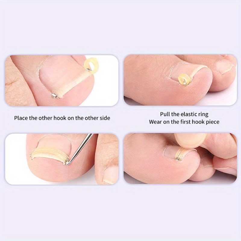 Nail Tools Set for Inward Growing Nails