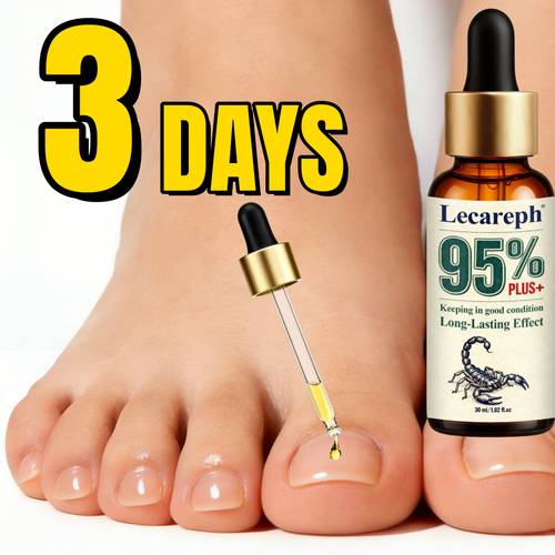ultra strength 95 toenail solution bee ginger extract provides 24 hour ongoing care for thickened discolored and damaged nails suitable for all nail types summer essential travel gifts