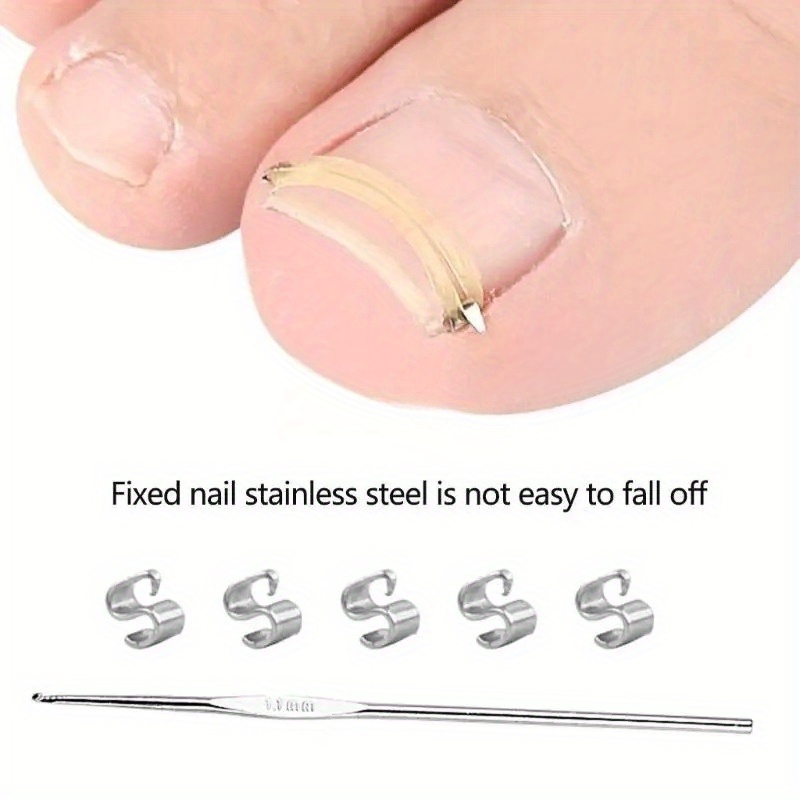 Ingrown Nail Tools Set for Easy Use