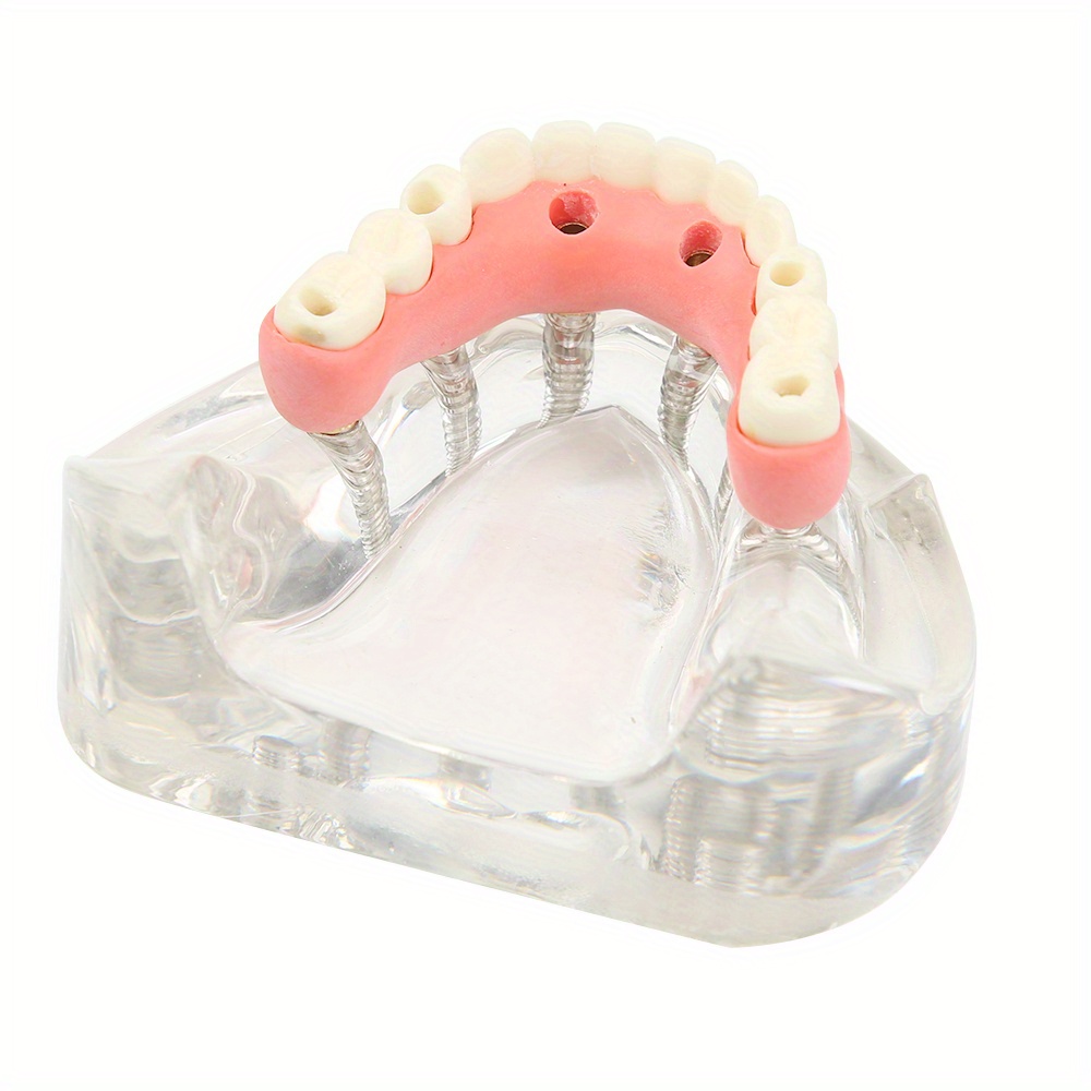 【裁断済み】2023 Dental Implantology 1-6号 セット dental implant model kit silicone teaching display set - Temu