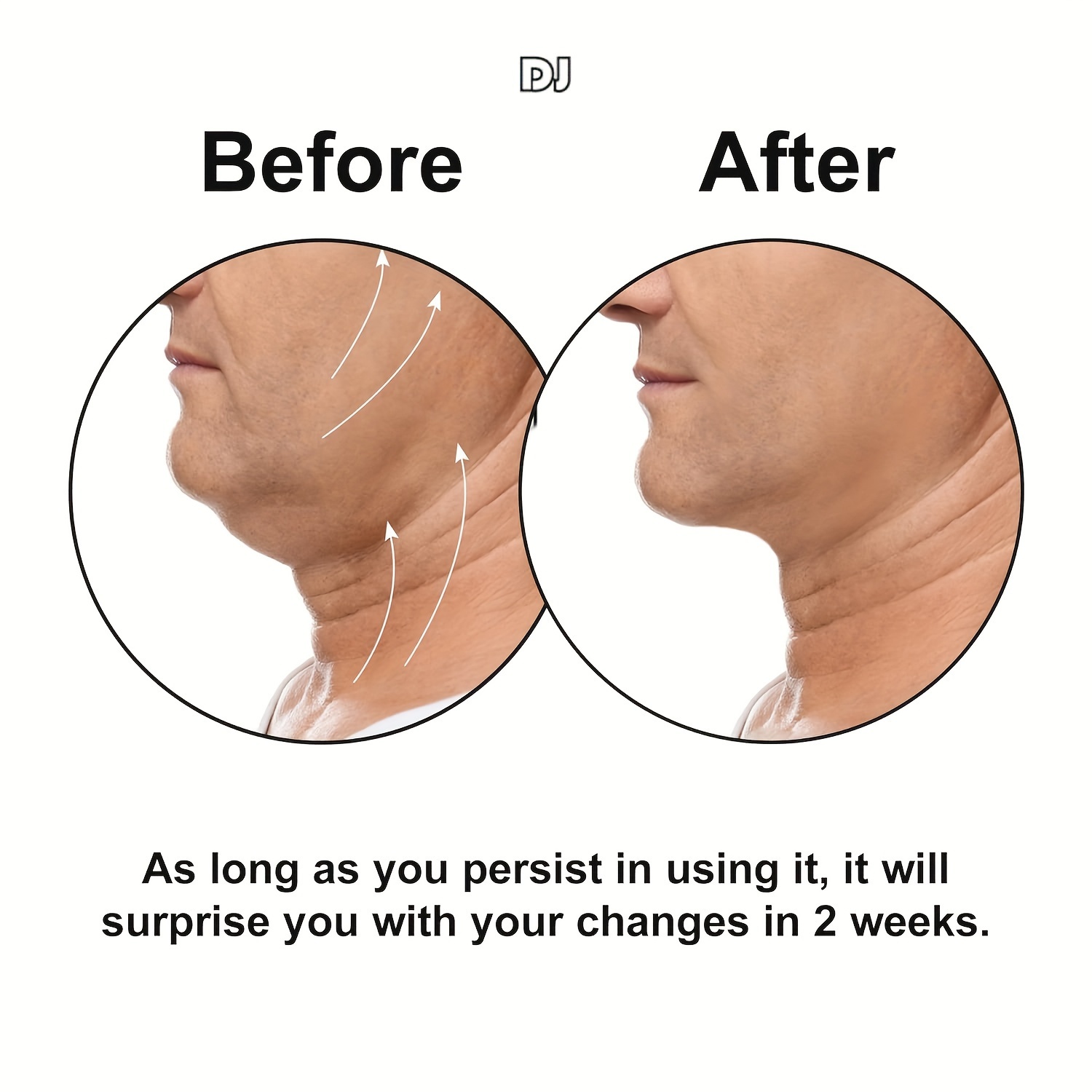 1/3pcs Silicone Masseter Muscle Training Ball | Upgraded Jaw Exerciser and Neck Toning Jawline Exerciser, Face Muscle Training, Non-Electric.