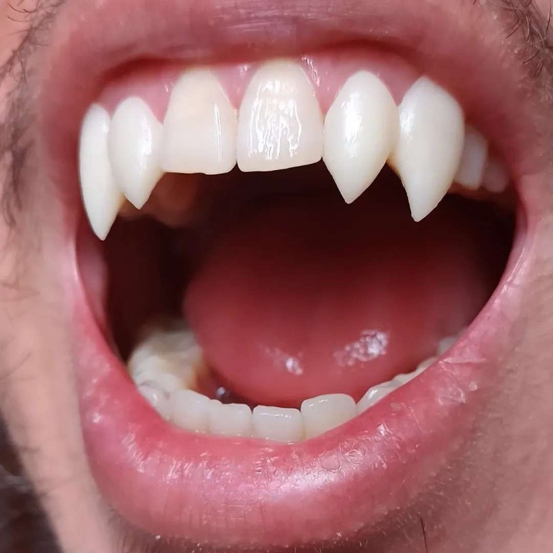 Halloween Hip-Hop Teeth Fake Teeth 5pcs Set for Cosplay
