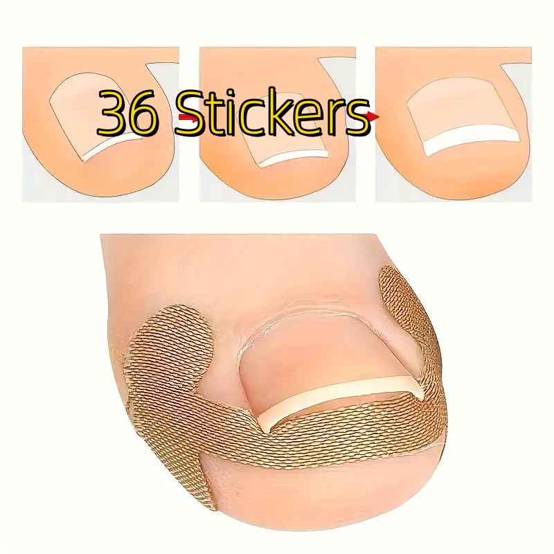 36pcs Self-adhesive Toe Nail Patches - No Glue Needed, Matte Nail Straighteners For Toenails
