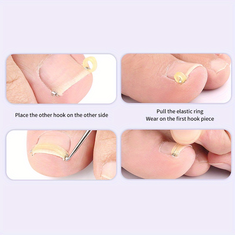 Ingrown Nail Tools Set for Easy Use