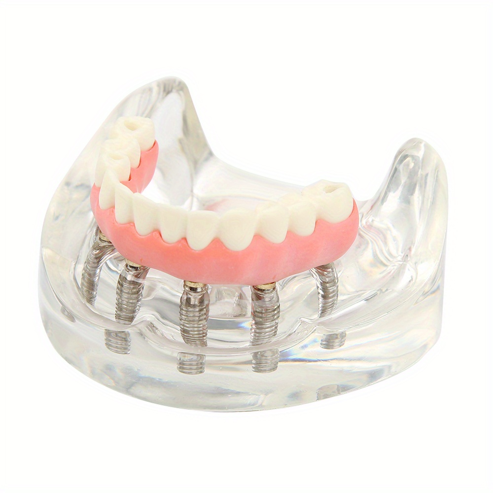 【裁断済み】2023 Dental Implantology 1-6号 セット 裁断済み】2023 Dental Implantology 1-6号 セット