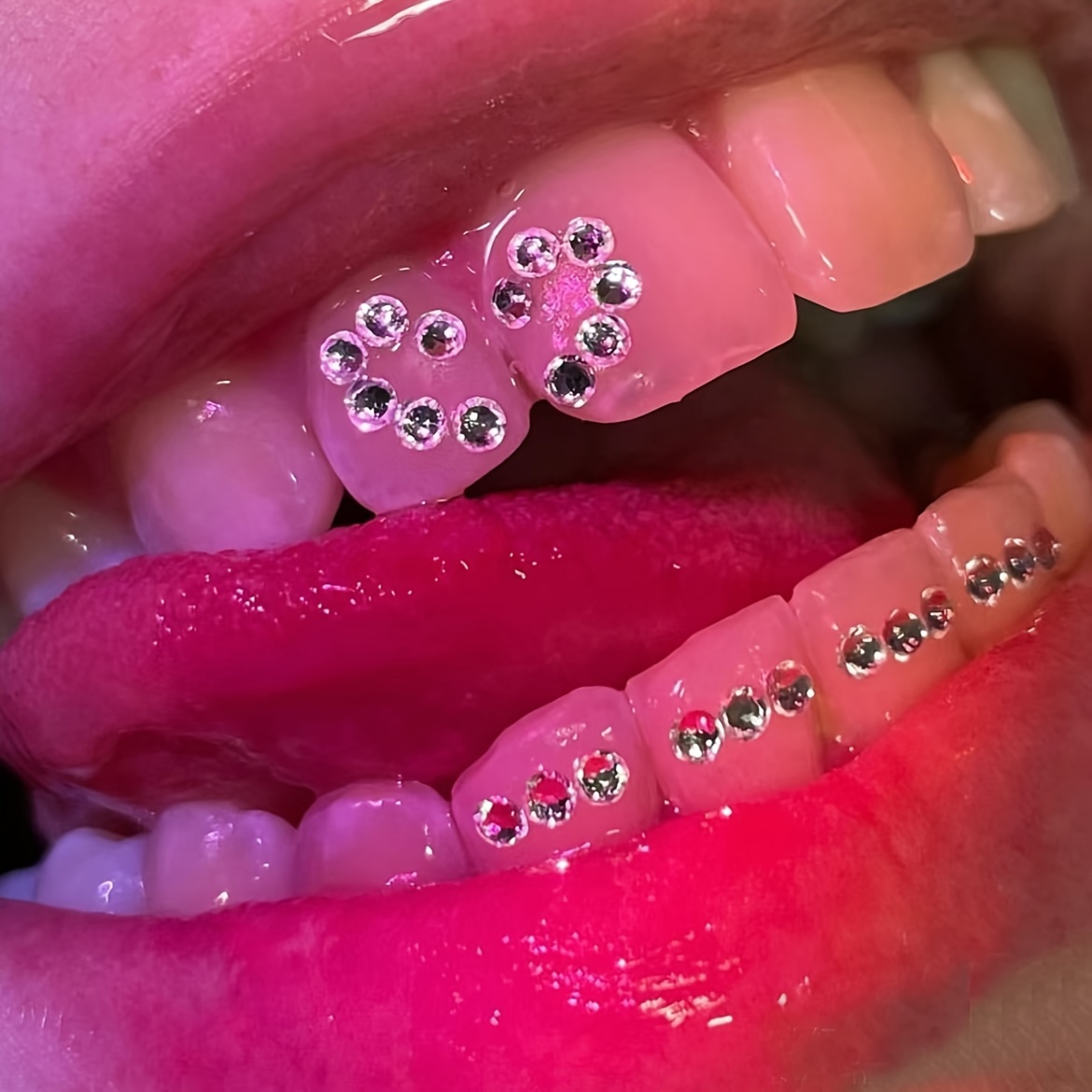 5Pcs/box Dental Tooth Ornaments Teeth Jewelry Gems Kit with Box Metal Tooth  Gems Decorative Jewelry for Teeth Dental Decorations - AliExpress