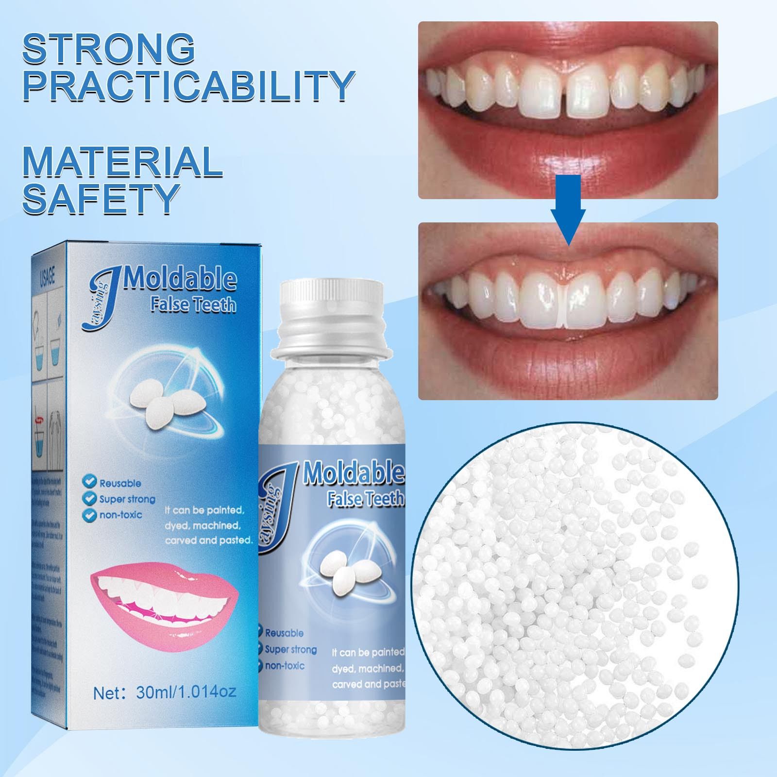 Thermal Fitting Beads, Tooth Filling Bead 100g Moldable Repair Temporary  Tooth Repair Bead for Broken Teeth Party