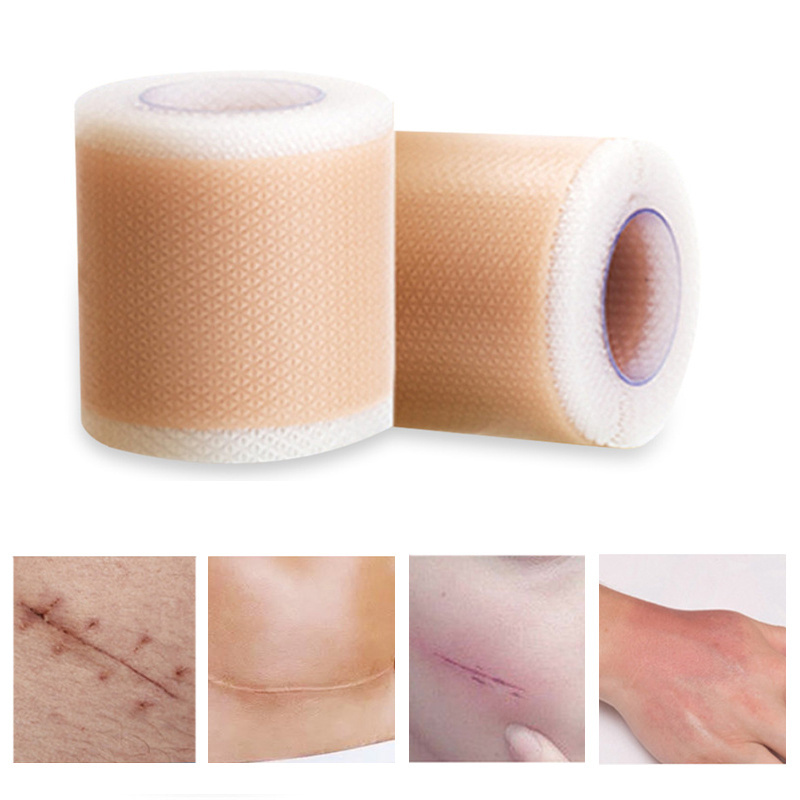 1 Roll Silicone Scar Strip, Efficient Beauty Scar Removal Silicone, Gel  Self-Adhesive Silicone Gel Tape Patch, For Acne Burn Scar Reduce Repair  Scar T