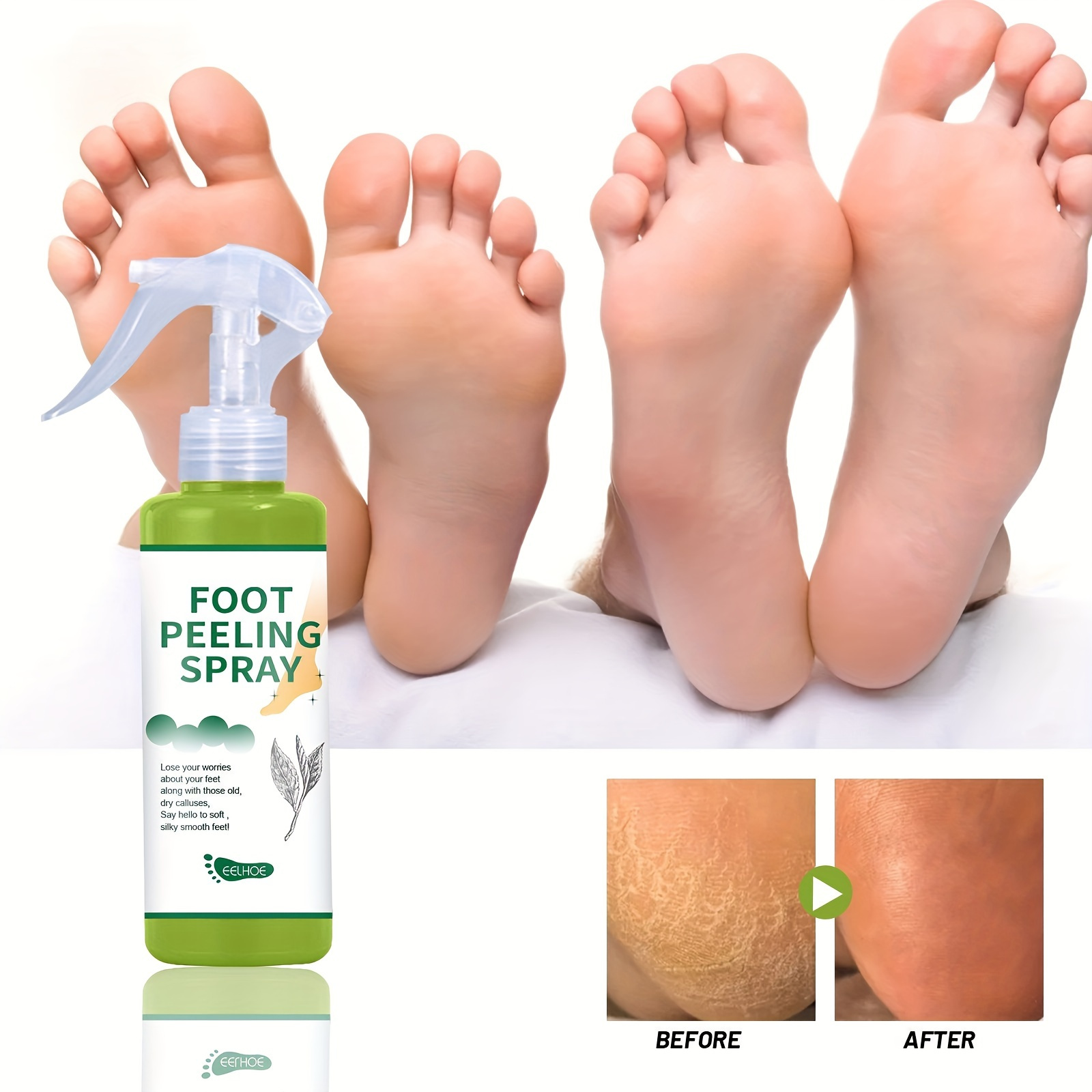 Foot Callus Remover Spray 1.01 Oz Quickly Soften Calluses