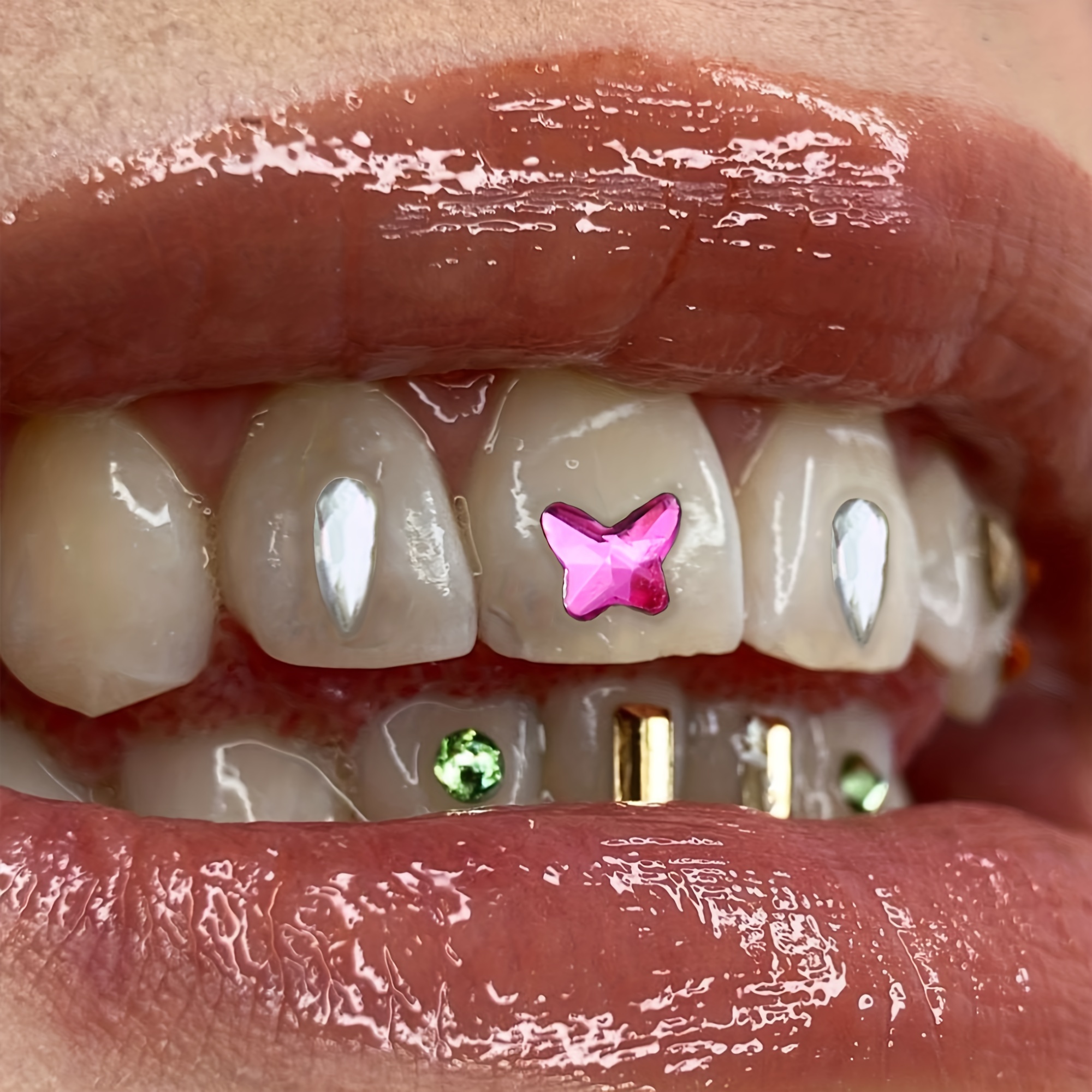 Kit De Gemas Dentales - Accesorios De Condimento - Fácil De Quitar E  Instalar - Taladro Dental De Cristal - Pegatina De Brillo Dental -  Decoración Del Hogar - Artículos De Viaje 